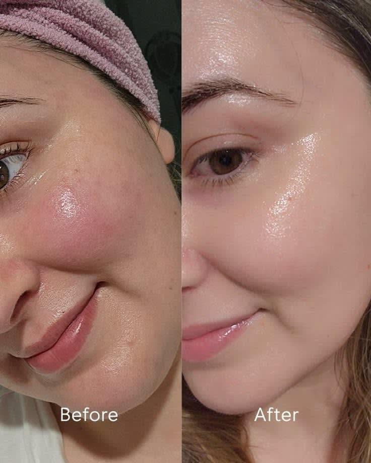 Dr. Althea 345 Relief Cream (50ml)
FA Safe — image 3